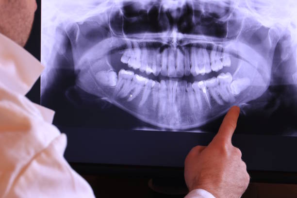 Best Emergency Cosmetic Dentistry (e.g., broken veneers) in Crystal Lake, IL